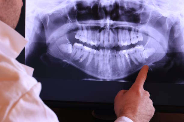 Best Mobile Emergency Dentist in Davenport, IA