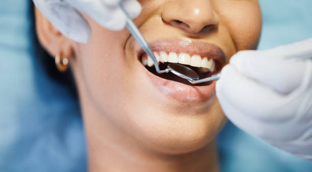 Best Emergency Dental Extractions in Davenport, IA